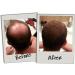 3D Hair Loss Fibres 35g - Dark Grey | Concealer for Thinning Hair - Buy Online on GoSupps.com