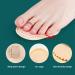 6-Piece Toe Straightener Set for Hammer, Claw, and Overlapping Toes - Beige - Buy Online on GoSupps.com