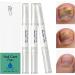 Nail repair pen and strengthening manicure care toenail repair pen for athletes women men seniors and adults - Buy Online on GoSupps.com