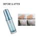 Waterfall Moist Balanced Hyaluronic Acid 100 Ampoule 20ml - Korean Skincare Rich Moisture Paraben Free Facial Hydration - Buy Online on GoSupps.com