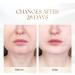 ANLAN Face Massager: Anti-Wrinkle Device with 3 Modes for Skin Tightening & Neck Lifting - EMS Massage for Women - Buy Online on GoSupps.com