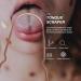 Stainless Steel U Shape Tongue Scraper - Portable Rose Gold Tongue Brush for Oral Care | Best Tongue Cleaning Tool for Adults - Buy Online on GoSupps.com