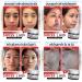 Swiss Lab Nature 3 Cream + 2 Serum Big Set | Ultimate 5 Pcs Skincare by Beautygoodshop | Free Beauty Gifts Included - Buy Online on GoSupps.com