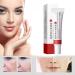 SGHOPLG 3Pcs Effective Whitening Freckle CreamRemove Melasma Acne Cream Fading Spot CreamAcne Scar Removal TreatmentFade Pigmentation Anti Melasma Brighten Skin Care Creams - Buy Online on GoSupps.com