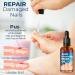 German Toenailcare Paronychia & Bunion Relief Oil for Thick, Discolored Nails - 1Pcs - Buy Online on GoSupps.com