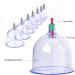Premium Cancer Therapy Set | Cupping Cups for Muscle Joint & Fascia Relief | Professional Butt Therapy Kit with Suction Gun & Magnets - Buy Online on GoSupps.com