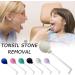 Portable Tonsil Stone Remover Kit - Oral Suction Tool for Adults (Purple) - Buy Online on GoSupps.com