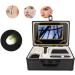 Box Type Hair Follicle Analyzer 9 Inch Skin Follicle Detector with LCD Display Screen and 50X/200X Lens Skin Diagnostic Scanner System for Home - Buy Online on GoSupps.com