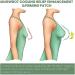 Flysmus Curvalux Breast Enhancement Set - Herbal Patches for Sagging Improvement (2PCS) - Buy Online on GoSupps.com