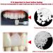 Temporary Tooth Repair Kit - Moldable Fake Teeth & Thermal Fitting Beads for Quick Tooth Replacement | White Teeth Repair Solution - Buy Online on GoSupps.com