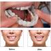 Buy Mxrfactory Teeth Prosthesis Pebble Gel Snap-On Smile | Temporary Cosmetic Tooth Set | Removable Braces Covers | 2 Pairs for Men - Buy Online on GoSupps.com