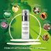 LOVVES S rum Visage Antitaches claircissant Haute Cosm tique Naturelle D pigmentant R duit les Hyperchromies de la Peau Pr vient la Formation de Nouvelles Taches Peau Plus Uniforme et Lumineuse - Buy Online on GoSupps.com