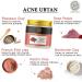 Buy Chemical-Free Acne Ubtan (50g) - Exfoliate Pimples & Rough Skin with Premium Clays | International Shipping - Buy Online on GoSupps.com