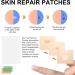 2-IN-1 Skin Tag Tool Kit for Men and Women Fast and Easy Micro Skin Tags Skin Tag Tool Kit for Medium to Large Skin Tags (2mm-7mm) Complete Skin Tag Tool Kit Safe for Most Parts - Buy Online on GoSupps.com