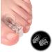 Big Toe Separators - Comfortable Fitting Toe Spacers to Reduce Pressure & Prevent Rubbing for Hammertoes - Reusable & International Shipping Available - Buy Online on GoSupps.com