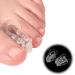 Toe Separators for Hammertoes - Reduce Friction, Prevent Rubbing - Reusable Toe Spacers - Buy Online on GoSupps.com