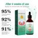 Dentizen Gingival Rejuvenation Drops - Natural Gum Repair for Receding Gums | 3 Pack | Effective Oral Care Solution - Buy Online on GoSupps.com