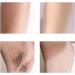 100PCS Non Woven Large 8x3inch Body and Facial Wax Strips Epilator Professional Hair Removal Wax Paper - Buy Online on GoSupps.com