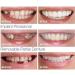 High-Quality Silicone Artificial Teeth & Veneers | Perfect Laugh Dentures for Upper & Lower Braces - Buy Online on GoSupps.com