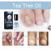 HOPASRISEE Onyxoguard Nail Growth and Repair Serum Onyxoguard Serum Nail Strengthener Nail Growth Serum Nail Growth and Strengthener Nail Serum for Strength and Growth (1) - Buy Online on GoSupps.com