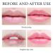 20pcs Moisturizing Lip Mask for Dry Lips - Pink Lip Care Treatment - Buy Online on GoSupps.com