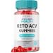 ACV for Keto Health Gummies - ACV Keto Health 750mg Advanced Weight Loss ACV for Keto Health Gummies with Apple Cider Vinegar Shark AC Keto + ACV Tank Supplement Belly Fat (60 Gummies)