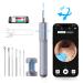 DTD Wireless Ear Otoscope 3.5mm 1080P HD Earwax Cleaning Tool for iOS Android Tablet