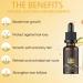 Hair Serum for Hair Growth Ginger Hair Regrowth Serum Ginger Hair Growth Oil for Thinning Repair Hair Follicles Hair Growth Oil for Hair Rapid Growth and Thickening Trengthen Hair Roots 20ML - Buy Online on GoSupps.com