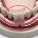 Tooth Brace Anti Teeth-Grinding Dental Guard | Molar Braces Sleep Protector | International Shipping Available - Buy Online on GoSupps.com
