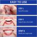 SSKHE 28-Piece 9D Tooth Whitening Set - Professional Non-Sensitive Formula for Deep Stain Removal - Buy Online on GoSupps.com