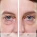 Avon ANEW Platinum Instant Eye Smoother - Target Under Eye Bags, Puffiness & Wrinkles - Buy Online on GoSupps.com