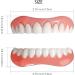 Yunpso Denture Silicone Reline Kit - Comfortable Teeth Veneers for Men & Women | International Shipping Available - Buy Online on GoSupps.com