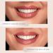 Lipliner & Lip Liner in Sunkissed Coral - Perfectly Define Your Lips | Shop Internationally - Buy Online on GoSupps.com