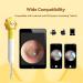 8MP HD Ear Wax Removal Tool with Camera and 6 LED Lights - Earwax Removal Kit for Kids and Adults - Ear Camera for iPhone, iPad, Android Phones - Q3 (Yellow with Kits) - Buy Online on GoSupps.com