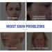 Face Sunscreen SPF 50 Cream (50ml) Hyaluronic Acid Watery Sun Gel - Buy Online on GoSupps.com