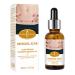 Aichun Beauty Removal Scar Premium Compound Essential Oil Repair Cells Reduces Scars Resists Acnes 30ml/1fl.oz