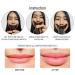 Lip Plumper Device | Manual Lip Enhancer for Natural Fuller Lips | Self-Suction Tool for Women | Perfect Girlfriend Gift - Buy Online on GoSupps.com
