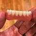 Adjustable Snap-On Dentures for Men - Eat, Smile & Cover Imperfections Instantly - Top & Bottom Set of Temporary Fake Teeth for Confidence Boost - Buy Online on GoSupps.com