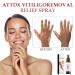 Vitiligo Removal Relief Spray - Skin Repair Formula (2 PCS) - Buy Online on GoSupps.com