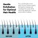 Wet Brush Exfoliating Scalp Massager - Blue Head Start Brush for Healthy & Strong Hair - Buy Online on GoSupps.com