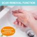 Silicone Away Scar Tape Roll - Reusable Waterproof Silicone Strips for Scar Removal - Professional C-Section, Keloids, Surgical, Acne Treatment - 1.6 x 150 - Buy Online on GoSupps.com