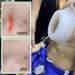 Vacuum Bell Pectus Excavatum - Physical Correction Pectus Excavatum Orthosis Brace Real-Time Pressure Gauge Monitoring(Large) - Buy Online on GoSupps.com