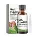 Nail Nourishing Solution | Multifunctional Nail Repair Drops | Nail Strengthening Drops | Hydrating Nail | Natural Nail Repair Remedy |-Infused Nail