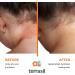 Terrasil Eczema and Psoriasis Cream | Calendula & Natural Ingredients | Eczema Relief for Severe Outbreaks | Soothes Rashes & Rosacea | Repairs Dry, Itchy Skin | 28g - Buy Online on GoSupps.com