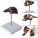 Liver Pathology Model Fatty Cirrhosis Carcinoma Demonstration Model Shows 7 Liver Diseases Detachable 2 Parts for Doctors Office Educational Tool - Buy Online on GoSupps.com