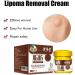 Wokii 3PCS Lipoma Removal Cream Lipoma Treatment Huangfutang Lipoma Removal Miaozu Huangfutang Lipoma Removal Cream Safe and Effective - Buy Online on GoSupps.com