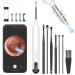 Ear Wax Removal Tool  Ear Cleaner with 1080P HD Camera  Ear Cleaner Kit with 7 PCS Ear Set  Wireless Otoscope with 6 Lights  Ear Wax Removal Kit for iPhone  iPad  Android Smart Phones(White)