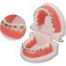 Orthodontic Tooth Model with Metal Brackets - Ideal for Teaching & Research in Laboratories | International Shipping - Buy Online on GoSupps.com