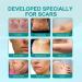 VOIV Scar Remover Spray 20g 5pcs - Relieves Itching, Removes Dark Acne - Dermatologist Recommended for All Types of Scars - Buy Online on GoSupps.com