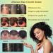 2023 Allurium Hair Growth Serum for Black Women - Nourish Dry, Damaged Hair Fast - Natural Hair Growth - 4PCS - Buy Online on GoSupps.com